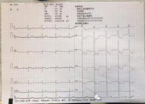 1639447692411291.jpg b.jpg